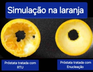 simulação do HBP em uma laranja